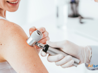 Dermatologist Orlando | Allergy & Asthma Center | Skin check, Acne, Skin Cancer, Moles