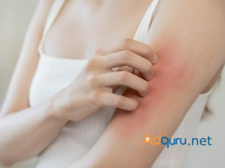 Texas Allergy Group, PLLC