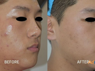 Florida’s Best Plastic Surgeons | Best Laser Skin Treatment Altamonte Springs, Orlando, Daytona Beach & Clermont