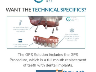 Dental Implants GPS