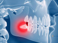 mcclane-dentistry-small-3